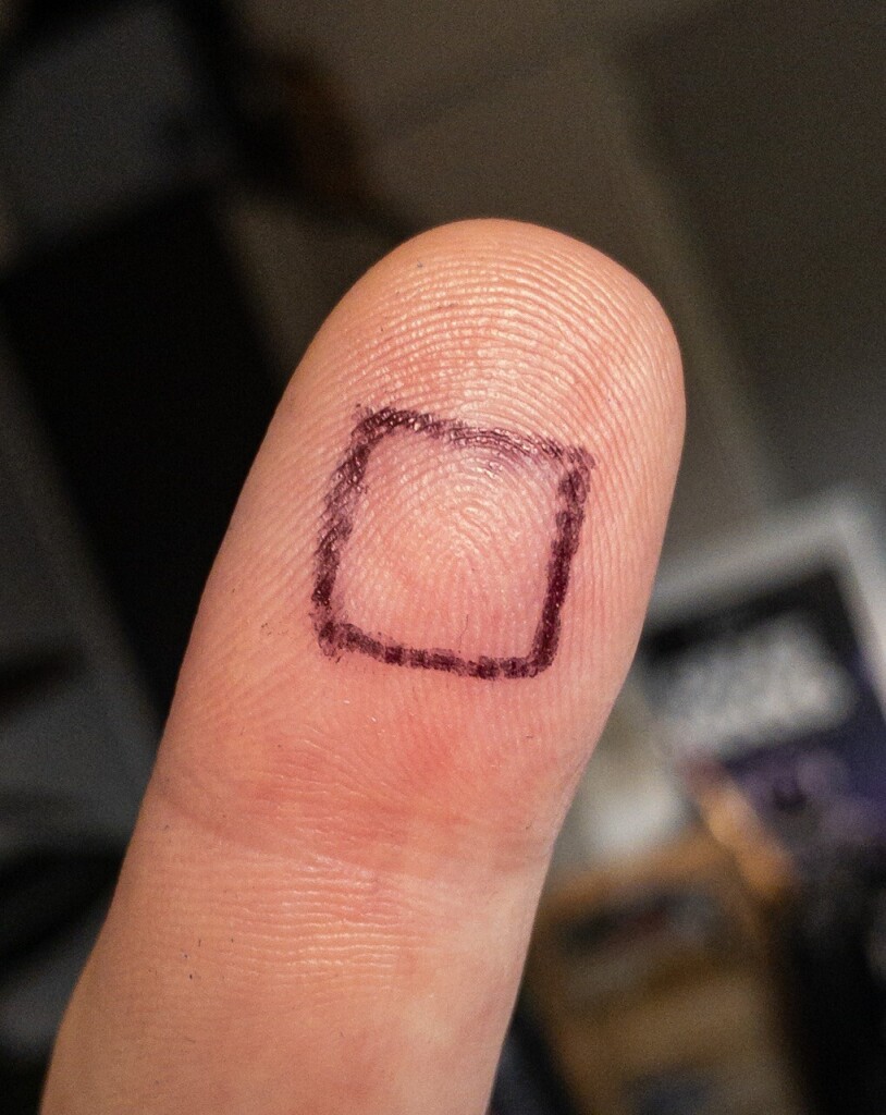 The tip of my left index finger with a one square centimetre box drawn on it in black biro.